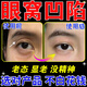 北京同仁堂眼窩凹陷修復眼貼填充改善眼皮松弛黑眼圈眼袋舒緩疲勞護眼貼 買(mǎi)二送一