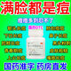 復方珍珠暗瘡片 祛痘藥治痘痘的藥姨媽痘紅腫膿包青春痘痤瘡皮膚紅斑丘疹濕瘡瘙癢去閉口粉刺去黑頭中藥 1瓶【輕度痘痘】