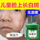 雪槐兒童祛白斑膏去汗斑霜小孩臉上白斑凈男女學(xué)生專用面霜正品