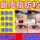 多年脂肪粒去除眼部專(zhuān)用藥育 汗管瘤去除膏 用于眼周白色顆粒油脂粒黑眼圈去藥除無(wú)痛專(zhuān)用藥膏 水楊酸軟膏 一支