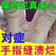 手指縫潰爛癢爛手指手指縫潰爛癢長(zhǎng)期碰水專(zhuān)用爛手丫手脫皮糜爛真菌感染汗?fàn)钆莅捳顨⒕拱W水泡發(fā)癢軟膏 單盒裝
