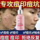 粉嫩公主 寡肽原液 痘痘精華液 痘印閉口粉刺  下巴長痘青春痘 痘坑紅腫痘 寡肽原液 三瓶