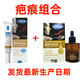 冰王樂施薰衣草疤痕修護(hù)去痘印淡化痘坑黑色素磕傷手術(shù)疤痕疤痕膏 薰衣草疤痕組合30ml+20g 發(fā)一瓶