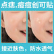 點(diǎn)痣防水貼隱形人工皮醫(yī)用臉部痘痘貼痘印透氣激光點(diǎn)斑傷口遮痣貼 圓形點(diǎn)痣貼100片裝1盒