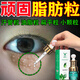去除i脂肪粒去除神器眼部專用的藥膏眼部汗管瘤眼周油脂粒祛掉粟丘疹臉部眼周白色顆粒黑眼圈細(xì)紋醫(yī)用精華液 單盒裝脂肪粒精華素