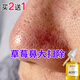 fUT清潔毛孔臟東西 收縮毛孔精華液果酸乳糖酸精華改善毛孔粗大男女 35ml