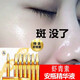 百幽草正品蝦青素小安瓶美肌白皙淡化斑點精華液提亮膚色緊致玻尿酸原液 3 盒 （含 21 支）【深度修復(fù)】