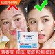 研春堂祛痘凈膚膏淡化痘印痘坑男女青春痘粉刺痤瘡精華凝膠改善痘痘 一支裝