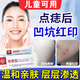 點(diǎn)痣去疤痕修復除疤膏兒童成人臉部淡化輔助去痘印黑色素疤印凹坑陷紅印疤痕臉上沉淀祛痣膏 單盒體驗裝