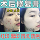 點(diǎn)痣疤痕修復(fù)非藥水無痕激光去祛點(diǎn)痣斑紋眉后修復(fù)膏臉部防疤去祛紅印凹坑黑印臉部激光術(shù)后點(diǎn)斑專用 【單盒體驗(yàn)裝】點(diǎn)痣疤痕