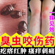帕洛驅蚊臭蟲(chóng)咬傷藥治毒蟲(chóng)蜱蟲(chóng)虱子跳蚤叮咬止癢消腫i炎膏寶寶蟲(chóng)咬抹靈 一瓶【體驗裝】
