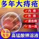 仁和高錳酸鉀洗液痔瘡坐浴專(zhuān)用溶液男士私處肛門(mén)瘙癢便血肉求清洗護理 買(mǎi)二 送一【三盒裝】
