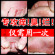 達克寧治腳氣藥止癢脫皮爛腳丫真菌感腳氣藥感染根膏藥治角化型干裂腳氣腳臭腳出汗專(zhuān)用藥腳臭硝酸咪康唑乳膏 1盒【腳臭腳出汗腳趾癢】正品速發(fā)