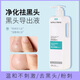 璟蔻（KINGCOUSE）去黑頭鼻貼導(dǎo)出液美容院專用祛粉刺收縮毛孔溫和不刺激 黑頭導(dǎo)出液第二代