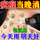 疣瘊靈去除脖子小肉粒猴子神器肉粒刺猴疙瘩去i疣體100%掉肉粒藥 1盒【體驗特效裝】癥狀輕試用