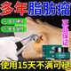 皮下脂肪包塊腫瘤膏成人單多發(fā)性脂腺囊腫粉瘤多部位皮下硬塊腫塊 1盒裝【30克】體驗裝