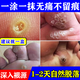 跖疣專(zhuān)用藥 跖疣腳底趾疣去看看根專(zhuān)用特治療效藥hpv去疣體非進(jìn)口跖疣膏雞眼老繭去除扁平疣 水楊酸軟膏 1盒【溶解角質(zhì) 無(wú)痛脫落】醫用快速去疣膏