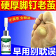 老繭軟化膏繭子去除器腳底厚繭死皮角質(zhì)腳趾關(guān)節繭軟化劑腳后跟硬皮腳掌腳墊手繭子抑菌液 買(mǎi)二發(fā)三【療程裝】多數人的選擇