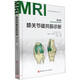 膝關(guān)節磁共振診斷(第3版)(精)/骨肌影像診斷技巧叢書(shū)
