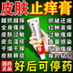 皮膚瘙癢皮炎濕疹真菌感染止癢越抓越癢皮膚藥膏止癢抑菌身體癢 皮膚用藥 曲安奈德益康唑乳膏【視覺(jué)特效】 1盒裝【殺菌止癢抑菌膏】