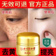 琦憶（HEAIQI）黃芪霜補(bǔ)水非去黃保濕黃褐斑老牌子正品黃芪霜淡斑去黃抗皺國(guó)貨黃 鞏固裝3盒