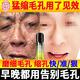 南京同仁堂收縮毛孔精華液去黑頭控油補水保濕修護細致毛孔粗大男女士 100ml 強力收縮毛孔 1瓶100ml