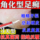 角化型足癬腳氣】腳后跟干裂膏真菌感染嚴(yán)重腳氣藥止癢脫皮爛腳丫真菌感染自腳營(yíng)干燥開裂脫皮硝酸咪康唑乳膏 1盒裝【腳后跟干裂疼痛】主圖視覺特效
