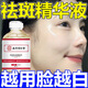 同仁堂美白祛斑精華祛斑霜淡化黑色素去雀斑黃褐斑提亮去黃改善暗沉膚色 一瓶裝【美白淡斑】