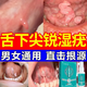 口腔尖銳濕疣專(zhuān)用膏藥hpv檢測(cè)抗病毒干擾素男女私處病毒感染通用 一個(gè)療程【口腔疣體小且少】輕度