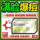 祛痘去痘痘消炎痤瘡專用閉口粉刺復(fù)方珍珠暗瘡片青春痘祛痘痤瘡專用藥臉上去痘痘的藥清熱解毒下巴紅腫硬痘痘 三盒裝【滿臉青春痘 消痘祛痘】 國藥準(zhǔn)字OTC 內(nèi)調(diào)消痘中成藥