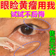眼瞼黃瘤祛去除眼角瞼黃疣克星眼瞼板腺堵塞脂肪粒汗管瘤眼部黃斑凸起眼周白色黃色顆粒軟膏 單盒體驗裝