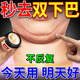 去雙下巴贅肉神器瘦脖子下顎線v臉提拉緊致收減雙下巴瘦臉溶脂器 一盒裝【一抹去除】