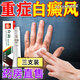 潤肌皮膚藥膏白顛癜風(fēng)去黑色素中藥消白斑膏正品外用官方正品 三支裝 周期裝
