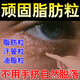 去除眼周白色顆粒脂肪粒去膏油脂粒眼睛脂肪粒汗管瘤小丘疹眼霜L 買二送一