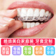皓齒美白牙套定制 Opalescence 美白牙托定制 SDI POLA美白牙套定制 【女】取模工具+7份材料+美白牙套定制費【上下】