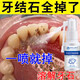 牙結(jié)石去除器洗牙齒去黃牙垢牙結(jié)石清除強(qiáng)力漱口水牙結(jié)石溶解液 單盒裝【牙結(jié)石克星】
