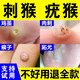 刺猴專(zhuān)用非藥肉粒疙瘩拓疣雞眼魚(yú)鱗痣扁平疣肉刺手腳脖子通用液體敷料膏 1盒裝（輕微癥狀）