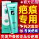 完美蘆薈膠疤痕修復凝膠去疤冷敷凝膠兒童除疤膏祛痘痘印淡化 2支裝第二支半價(jià)
