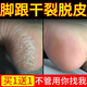 森卓腳后跟足跟干裂膏足裂龜裂腳裂開裂脫皮腳底手足皸裂膏防裂非修復(fù) 腳干裂脫皮【膚裂寶+腳跟套1對】