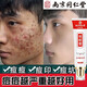 南京同仁堂水楊酸祛痘膏學(xué)生青春痘祛痘印修復淡化痘印痘坑修復男女 一支裝【體驗款】 30g