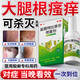 股蘚大腿內側真菌感染腹股溝股癬膏大腿根內測潮濕瘙癢癬藥水噴霧專(zhuān)用藥真菌感染皮膚用藥鹽酸特比萘芬噴霧劑 3盒【股癬反復長(cháng)】【視覺(jué)特效】
