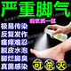 腳氣藥止癢脫皮爛腳丫真菌感染止癢鹽酸特比萘芬噴霧劑腳趾縫潰爛癢開(kāi)裂水泡腳氣噴劑止癢殺菌治腳癬特用效藥 1盒裝【噴一噴 殺菌止癢】