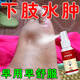 水腫消腫浮腫下肢水腫藥 消腫消除水腫利臉腫四肢腫老人腳腫全身浮腫走不了路去腫濕神器J 單盒30ml