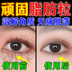 維A酸乳膏 脂肪粒去除眼部非專(zhuān)用藥育 汗管瘤去除膏 用于眼周白色顆粒油脂粒黑眼圈去藥除無(wú)痛專(zhuān)用藥膏 1盒裝【幾粒脂肪?！? title=