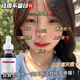 力克寧痘痘神器水楊酸精華液溫和祛痘淡化痘印去痘坑痘疤去粉刺閉口 買(mǎi)1送1【控制多余油脂】體驗裝