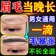 眉毛增長(cháng)液男濃眉增長(cháng)私處毛發(fā)胡須頭發(fā)生長(cháng)液睫毛增長(cháng)液快速增長(cháng) 一瓶裝【已售99+】