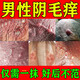 克霉唑乳膏陰部瘙癢私處止癢軟膏陰囊潮濕瘙癢男人專用止癢去好根大腿內(nèi)側(cè)真菌感染止癢殺菌皮膚用藥非處方藥 1盒裝【專攻男性陰部瘙癢】