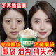 仕月蟲(chóng)草眼霜淡化細紋提拉緊致抗皺去除黑眼圈眼袋熬夜魚(yú)尾紋男女士 蟲(chóng)草眼霜2瓶：60克