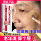 傾齡祛斑祛黑色素老年斑滋潤斑點(diǎn)臉部強力去除專(zhuān)用手背祛斑霜新年禮物