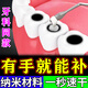 奕康本草補牙齒神器材料永久自己在家洞醫用高硬度樹(shù)脂進(jìn)口納米修復填充劑 升級版【送;探針+口鏡】適合新手